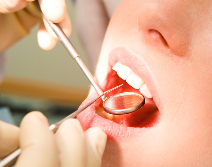 Information Regarding Dental Implants in Chicago