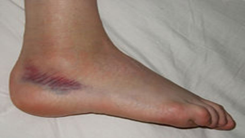 What Are Podiatrists Saying About Footwear and Long-Term Health