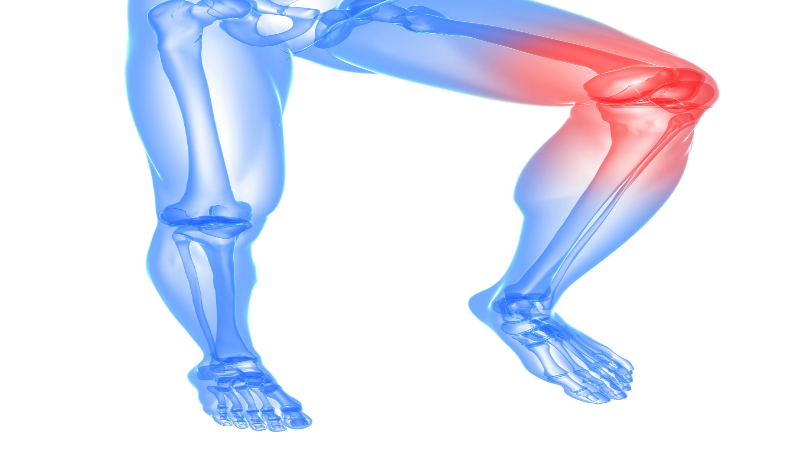 Helpful tips for relieving pain from Runners knee
