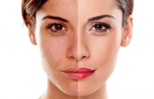 How MINT PDO Can Give You Better Skin Without Going Under The Knife
