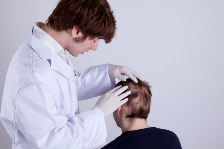 Overcome Age and Genetics with a Natural Hair Transplant in Great Neck, NY
