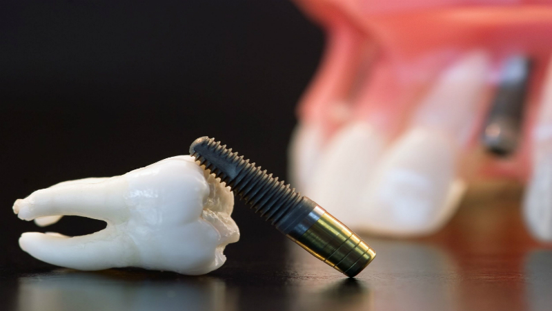 Finding General Dentistry in Manassas Park