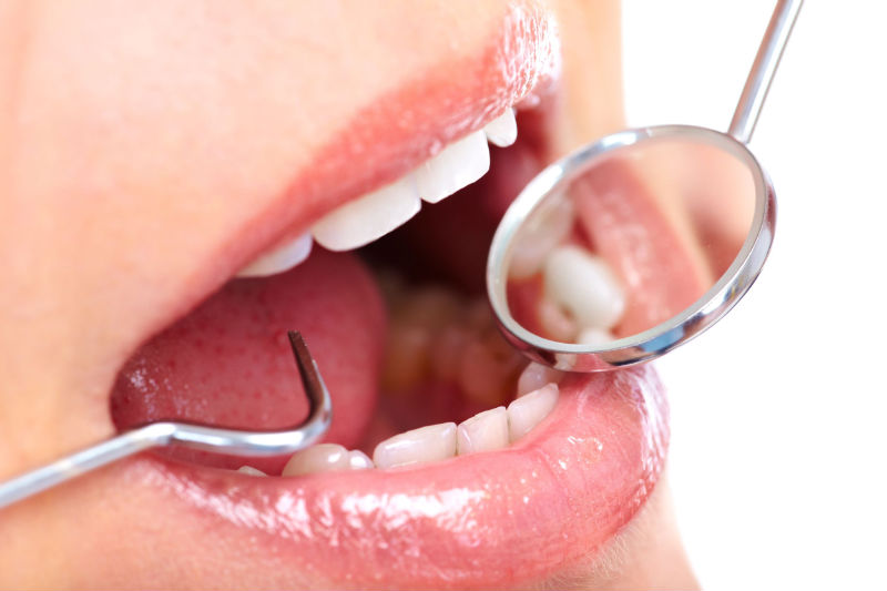 4 Tips to Help You Find the Most Reliable Emergency Dentist in Los Angeles