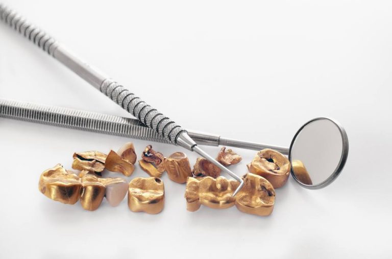 Sell Dental Gold: The Smart Choice for Dental Businesses