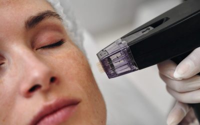 Experience smoother skin with Agnes laser treatment in Peachtree City for lasting confidence