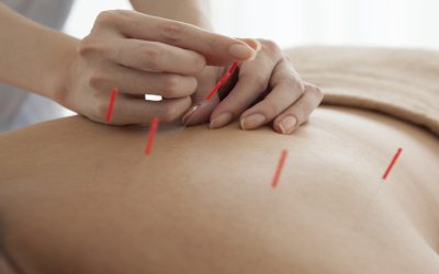 See Lasting Results with Acupuncture, Berkeley, CA, for Holistic Healing Solutions