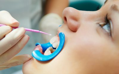 Signs You Need Wisdom Tooth Removal Louisville Dentists Say to Watch For